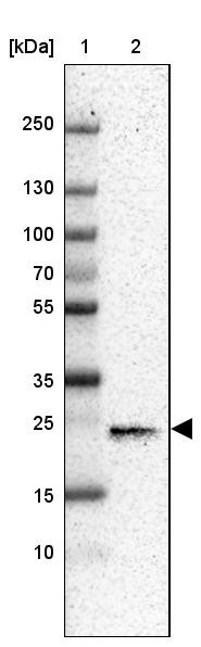 Lane 1: Marker [kDa] 250, 130, 100, 70, 55, 35, 25, 15, 10<br/>Lane 2: Human cell line MOLT-4
