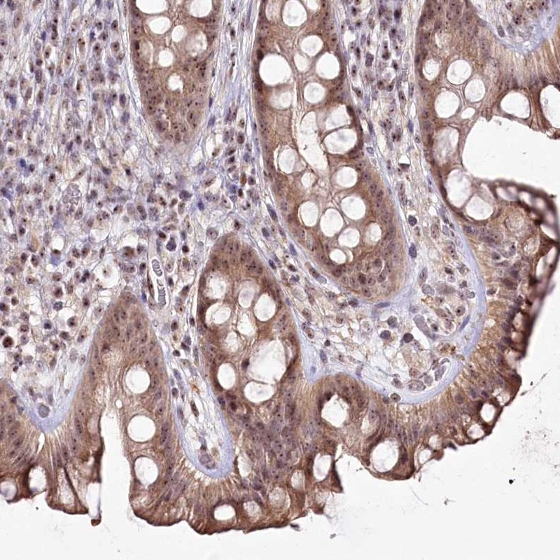 Immunohistochemical staining of human rectum shows moderate cytoplasmic and nucleolar positivity in glandular cells.