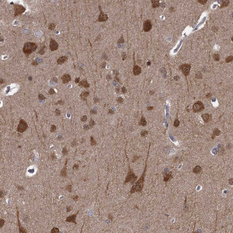 Immunohistochemical staining of human cerebral cortex shows strong cytoplasmic positivity in neuronal cells and moderate in neuropil.