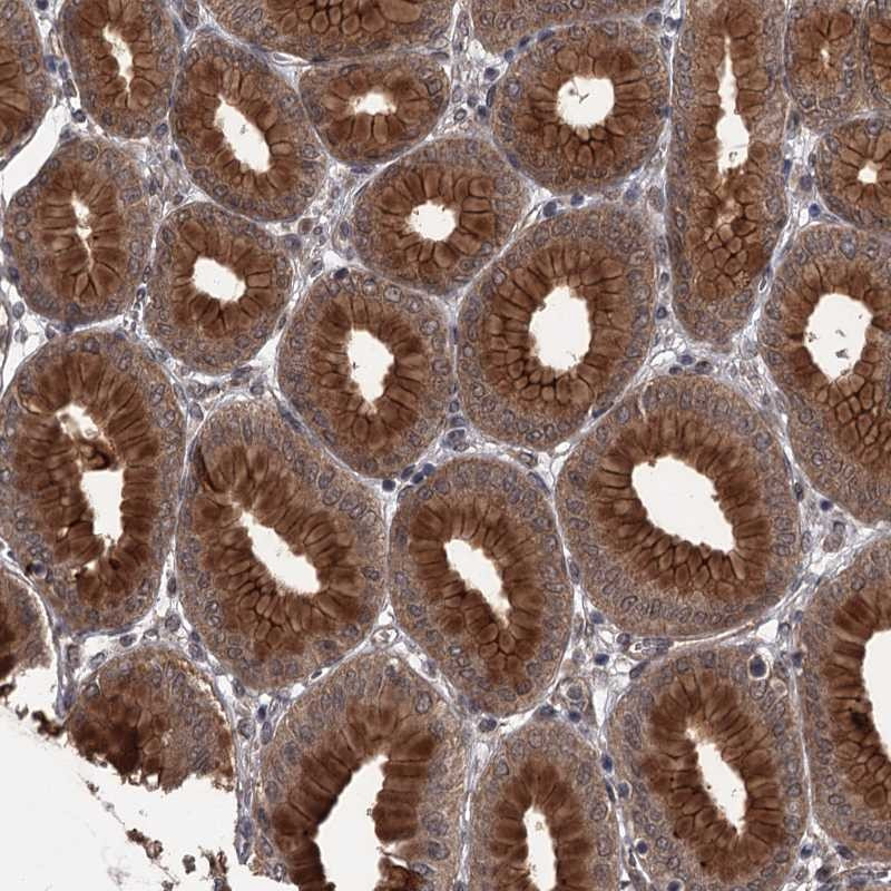Immunohistochemical staining of human stomach shows string cytoplasmic and membrane positivity in glandular cells.