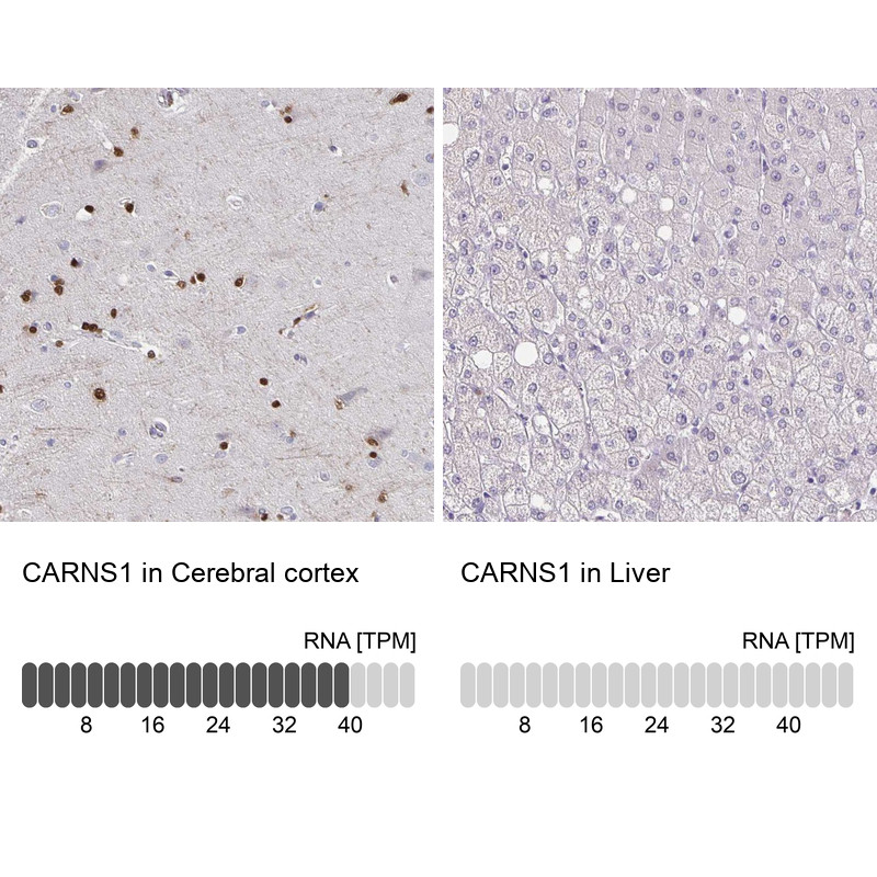 Immunohistochemistry analysis in human cerebral cortex and liver tissues using Anti-CARNS1 antibody. Corresponding CARNS1 RNA-seq data are presented for the same tissues.