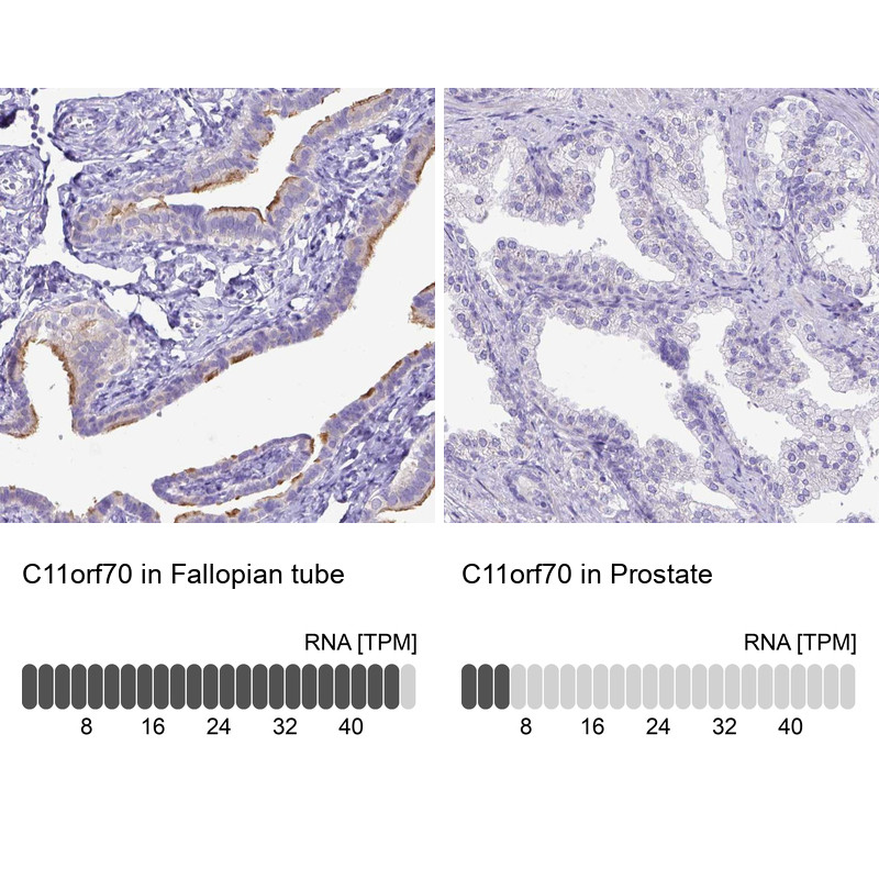 Immunohistochemistry analysis in human fallopian tube and prostate tissues using Anti-C11orf70 antibody. Corresponding C11orf70 RNA-seq data are presented for the same tissues.