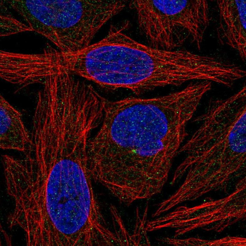 Immunofluorescent staining of human cell line SiHa shows localization to centrosome.