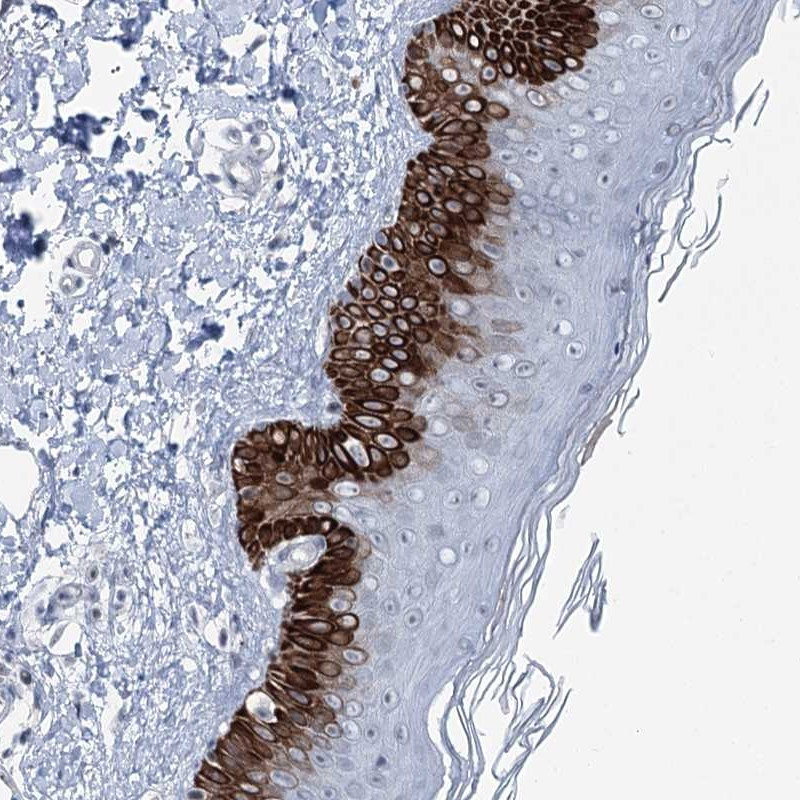 Immunohistochemical staining of human skin shows strong cytoplasmic positivity in epidermal cells.