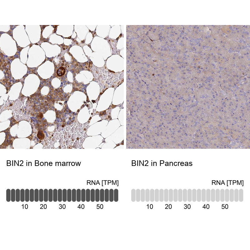 Immunohistochemistry analysis in human bone marrow and pancreas tissues using Anti-BIN2 antibody. Corresponding BIN2 RNA-seq data are presented for the same tissues.