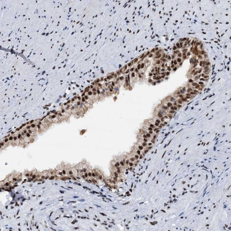 Immunohistochemical staining of human prostate shows strong nuclear positivity in glandular cells.