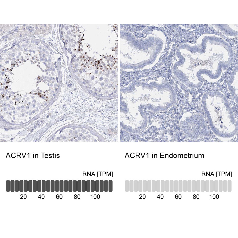 Immunohistochemistry analysis in human testis and endometrium tissues using Anti-ACRV1 antibody. Corresponding ACRV1 RNA-seq data are presented for the same tissues.
