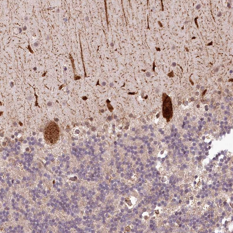 Immunohistochemical staining of human cerebellum shows strong cytoplasmic positivity in Purkinje cells.