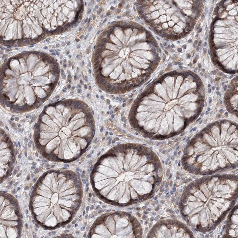 Immunohistochemical staining of human rectum shows cytoplasmic positivity in glandular cells.