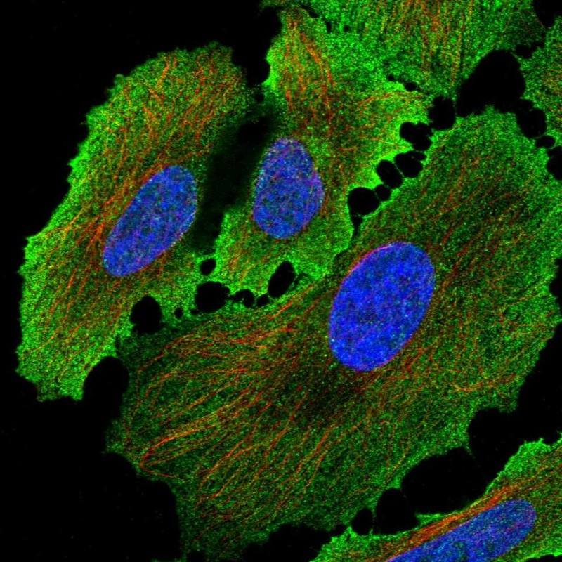 Immunofluorescent staining of human cell line HeLa shows localization to plasma membrane.
