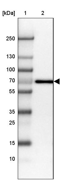 Lane 1: Marker [kDa] 250, 130, 100, 70, 55, 35, 25, 15, 10<br/>Lane 2: Human Placenta tissue