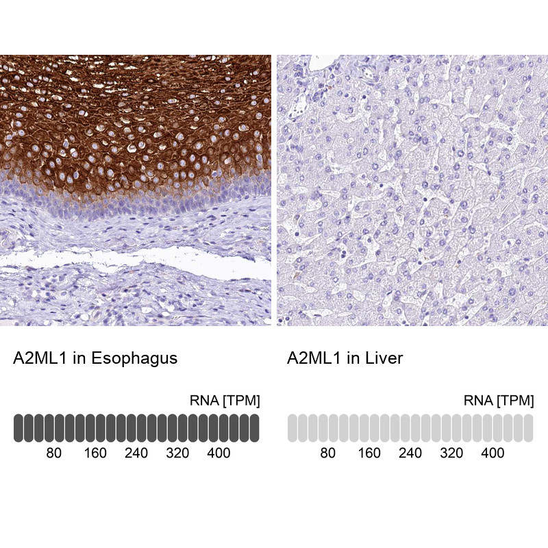 Immunohistochemistry analysis in human esophagus and liver tissues using HPA038847 antibody. Corresponding A2ML1 RNA-seq data are presented for the same tissues.