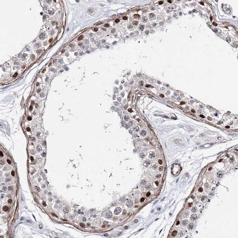 Immunohistochemical staining of human testis shows strong cytoplasmic and nuclear positivity in spermatogonia.