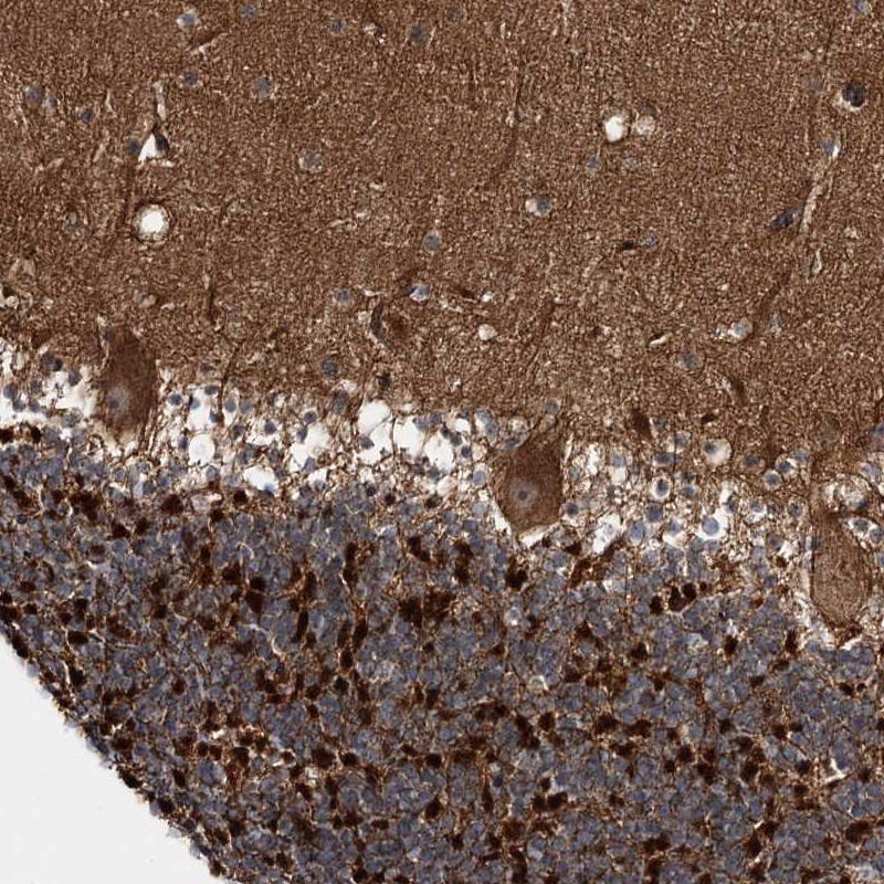 Immunohistochemical staining of human cerebellum shows strong cytoplasmic positivity in Purkinje cells.