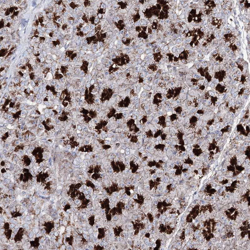 Immunohistochemical staining of human pancreas shows strong cytoplasmic positivity in exocrine glandular cells.
