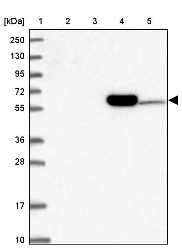 Lane 1: Marker [kDa] 250, 130, 95, 72, 55, 36, 28, 17, 10<br/>Lane 2: Human cell line RT-4<br/>Lane 3: Human cell line U-251MG sp<br/>Lane 4: Human plasma (IgG/HSA depleted)<br/>Lane 5: Human liver tissue