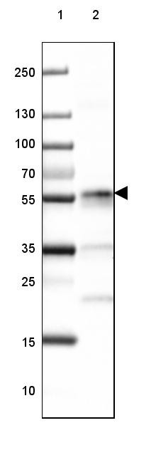 Lane 1: Marker [kDa] 250, 130, 100, 70, 55, 35, 25, 15, 10<br/>Lane 2: Human cell line Daudi