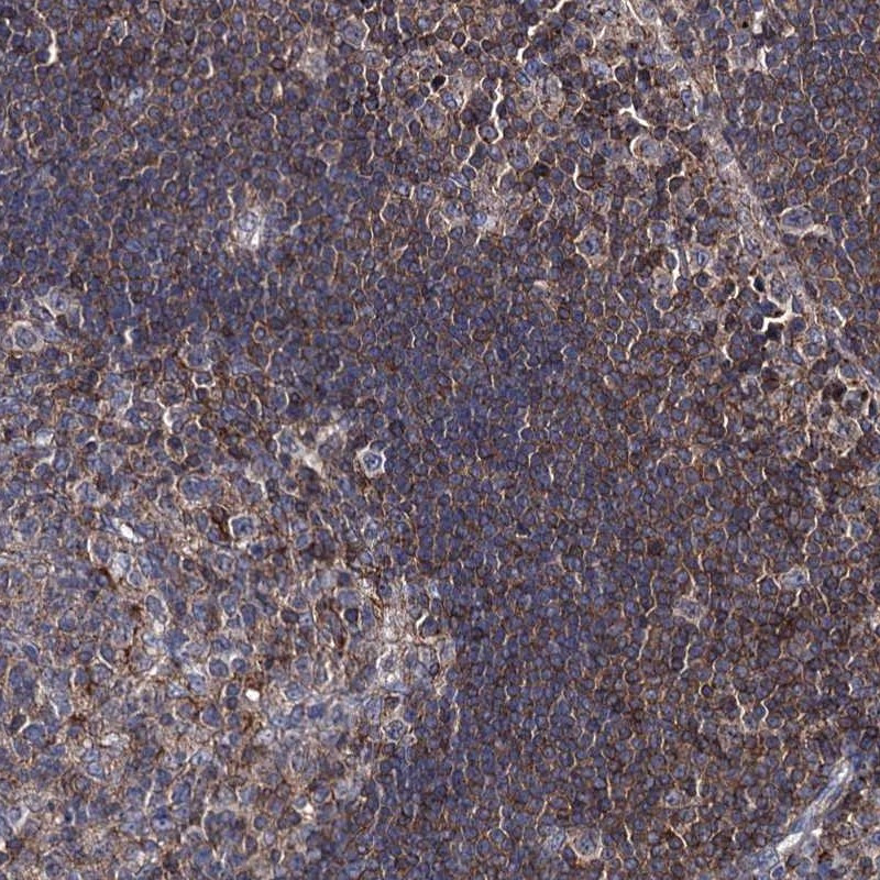 Immunohistochemical staining of human lymph node shows moderate cytoplasmic positivity.