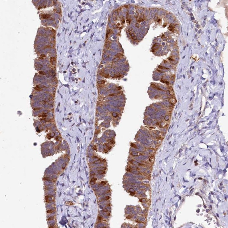 Immunohistochemical staining of human fallopian tube shows strong cytoplasmic positivity in a subset of glandular cells.