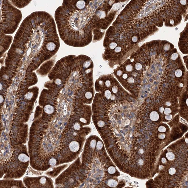 Immunohistochemical staining of human small intestine shows strong cytoplasmic positivity in glandular cells.