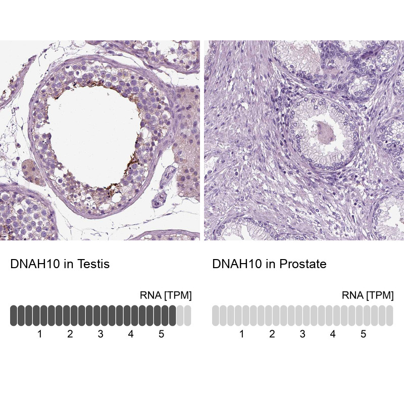 Immunohistochemistry analysis in human testis and prostate tissues using HPA039066 antibody. Corresponding DNAH10 RNA-seq data are presented for the same tissues.