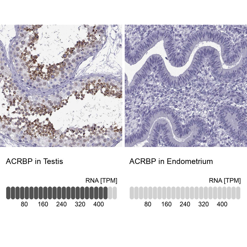 Immunohistochemistry analysis in human testis and endometrium tissues using Anti-ACRBP antibody. Corresponding ACRBP RNA-seq data are presented for the same tissues.