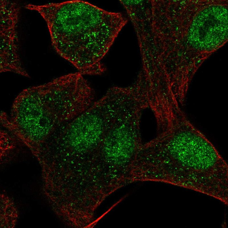 Immunofluorescent staining of human cell line A549 shows localization to nucleoplasm & vesicles.