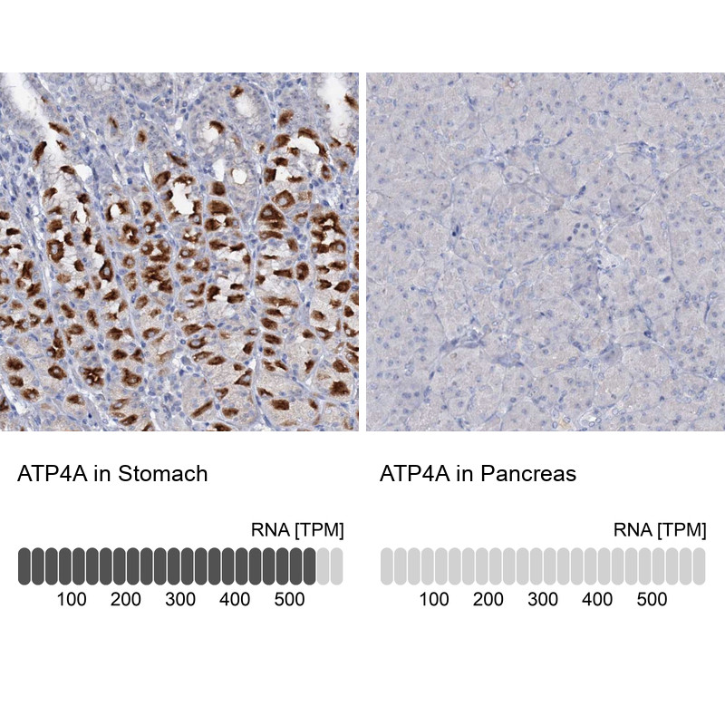Immunohistochemistry analysis in human stomach and pancreas tissues using Anti-ATP4A antibody. Corresponding ATP4A RNA-seq data are presented for the same tissues.