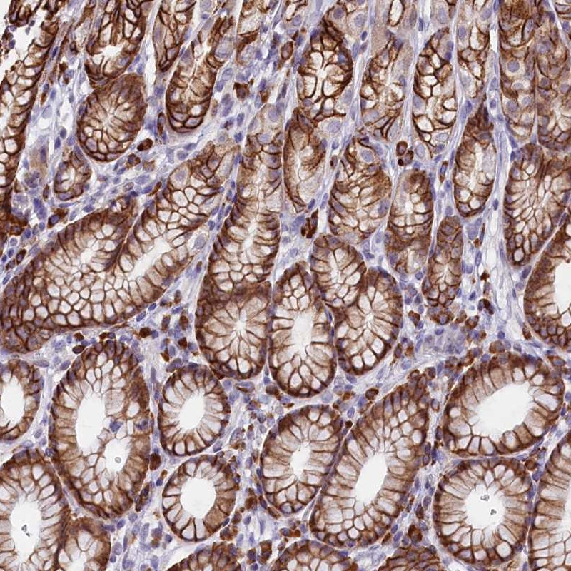 Immunohistochemical staining of human stomach shows strong cytoplasmic and membranous positivity in glandular cells.