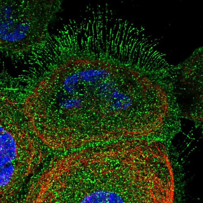 Immunofluorescent staining of human cell line A-431 shows localization to plasma membrane & cytosol.