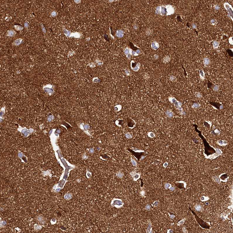 Immunohistochemical staining of human cerebral cortex shows strong positivity.