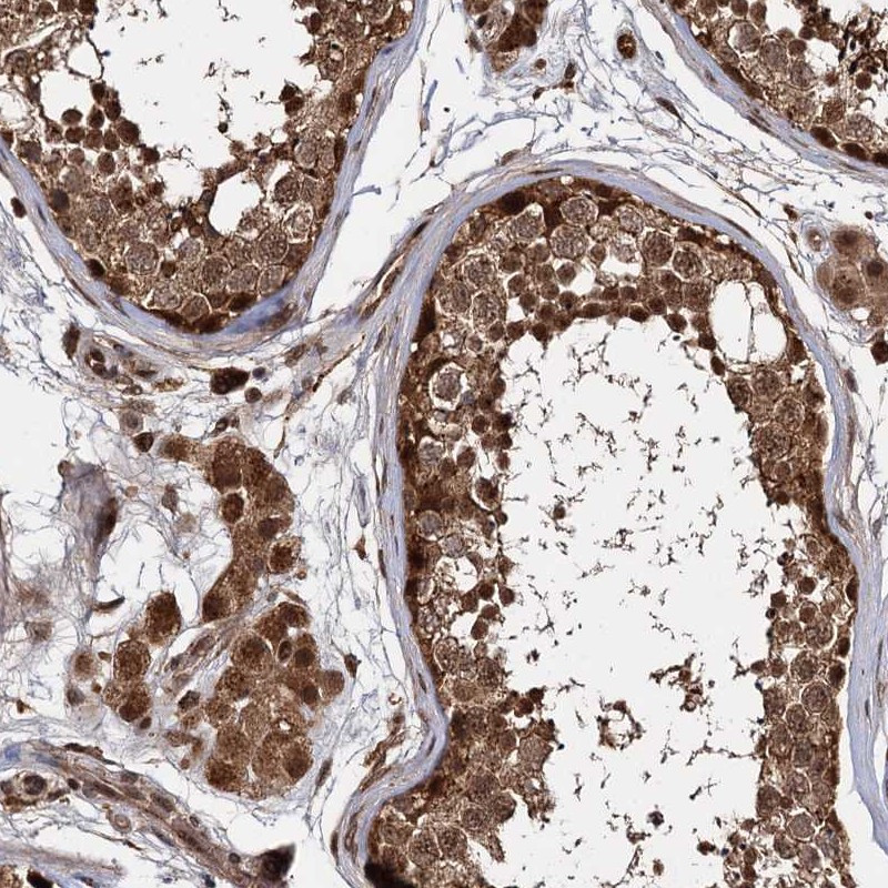 Immunohistochemical staining of human testis shows strong nuclear and cytoplasmic positivity.