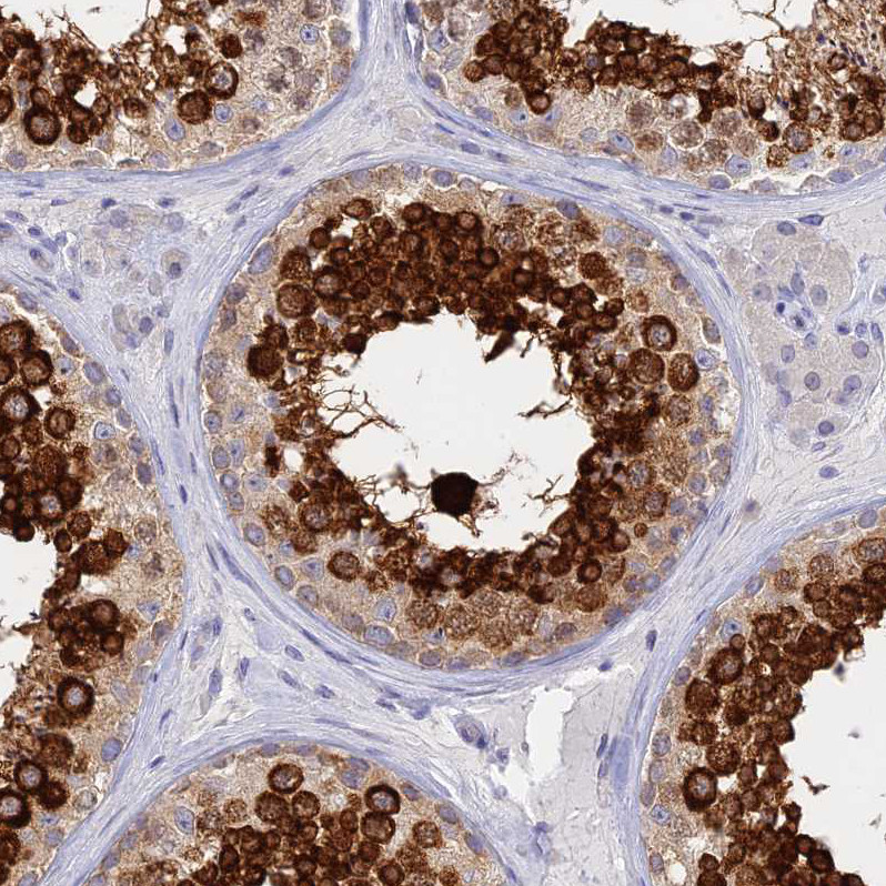 Immunohistochemical staining of human testis shows strong cytoplasmic positivity in cells in seminiferous ducts.