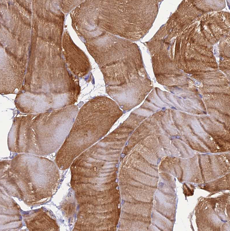 Immunohistochemical staining of human skeletal muscle shows moderate cytoplasmic positivity in myocytes.