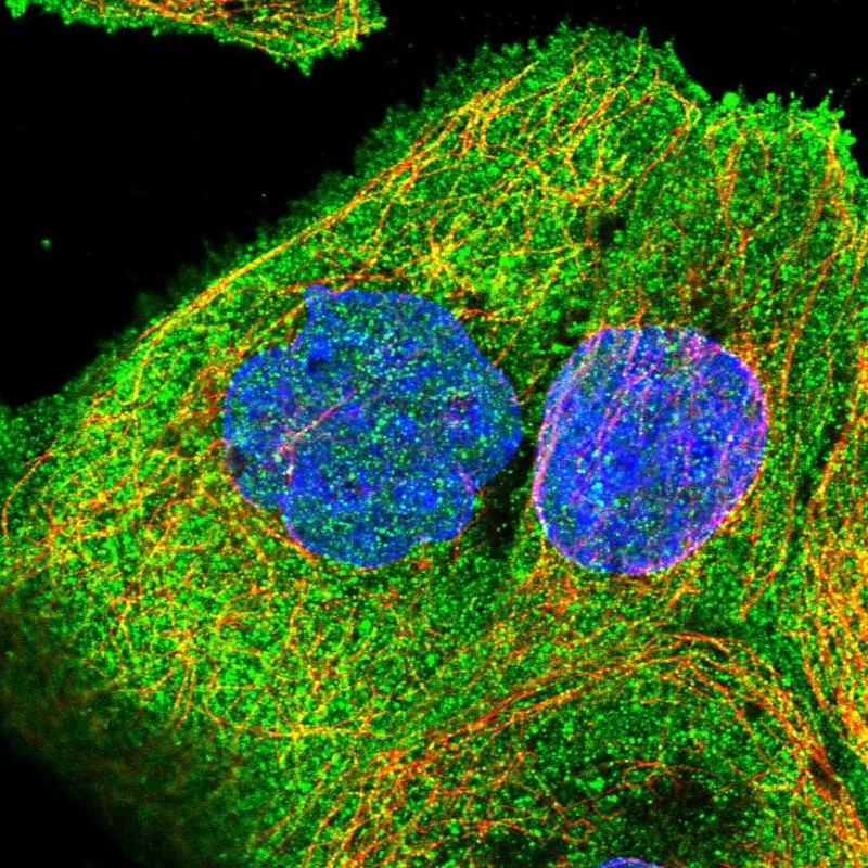 Immunofluorescent staining of human cell line A-431 shows localization to plasma membrane.