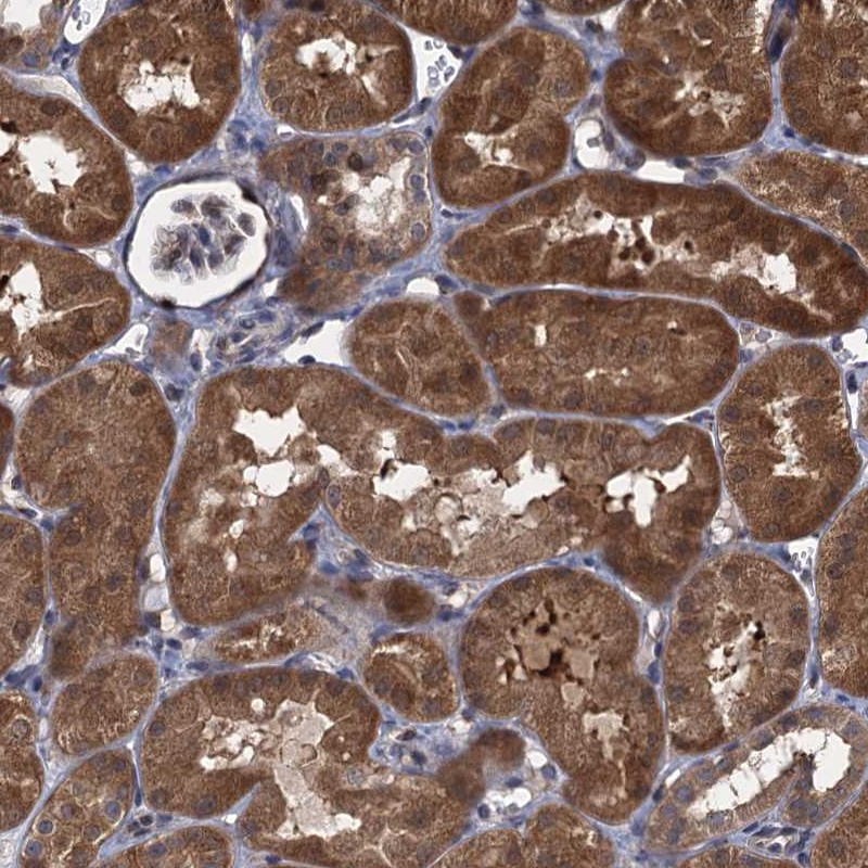Immunohistochemical staining of human kidney shows strong cytoplasmic positivity in tubular cells.