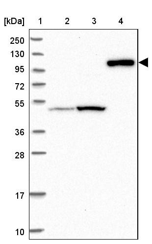 Lane 1: Marker [kDa] 250, 130, 95, 72, 55, 36, 28, 17, 10<br/>Lane 2: Human cell line RT-4<br/>Lane 3: Human cell line U-251MG sp<br/>Lane 4: Human plasma (IgG/HSA depleted)