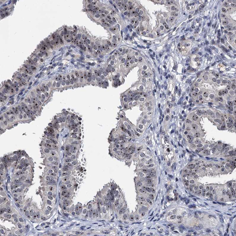 Immunohistochemical staining of human fallopian tube shows strong positivity in nucleoli in glandular cells.