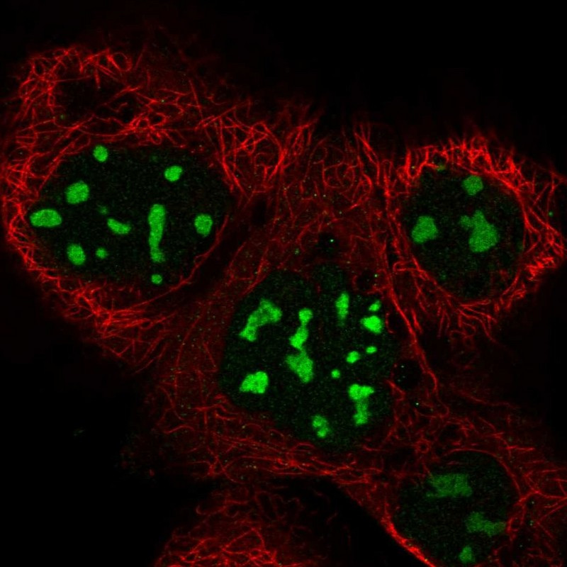 Immunofluorescent staining of human cell line A-431 shows localization to nucleoli.