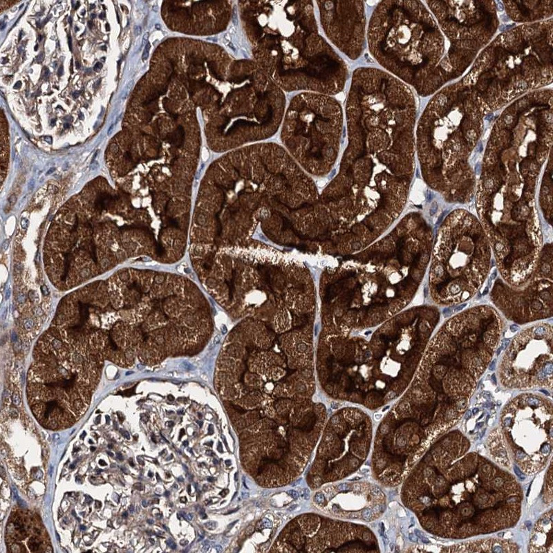 Immunohistochemical staining of human kidney shows strong cytoplasmic and membranous positivity in tubules.