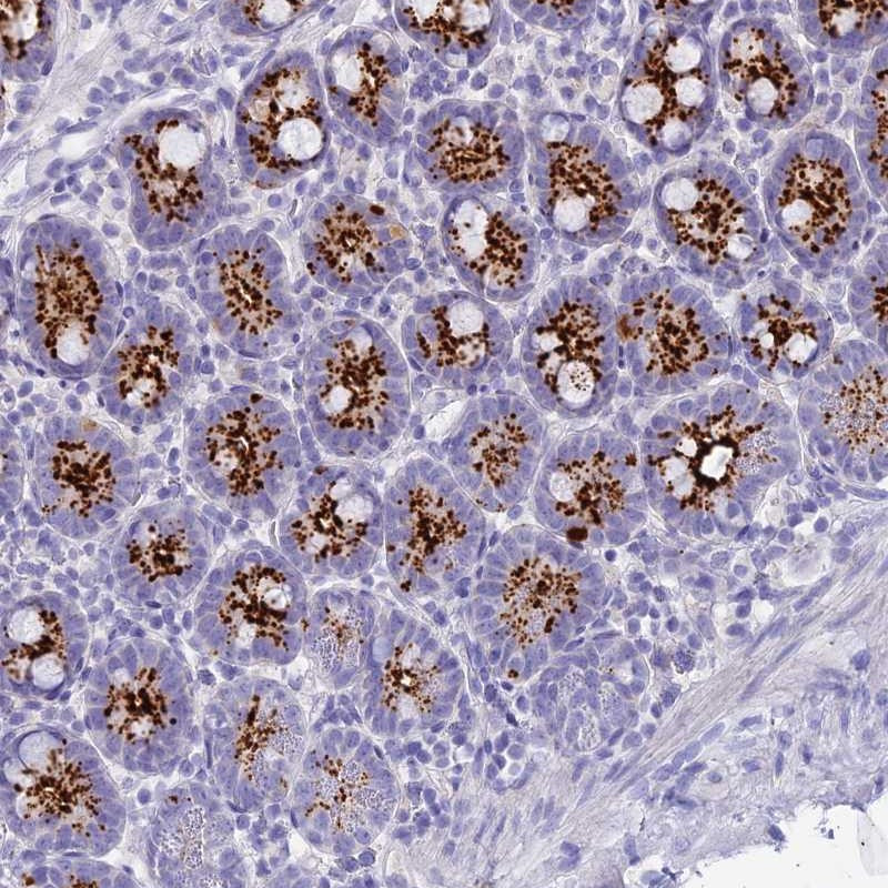 Immunohistochemical staining of human small intestine shows strong cytoplasmic positivity, seen with a granular pattern in glandular cells.