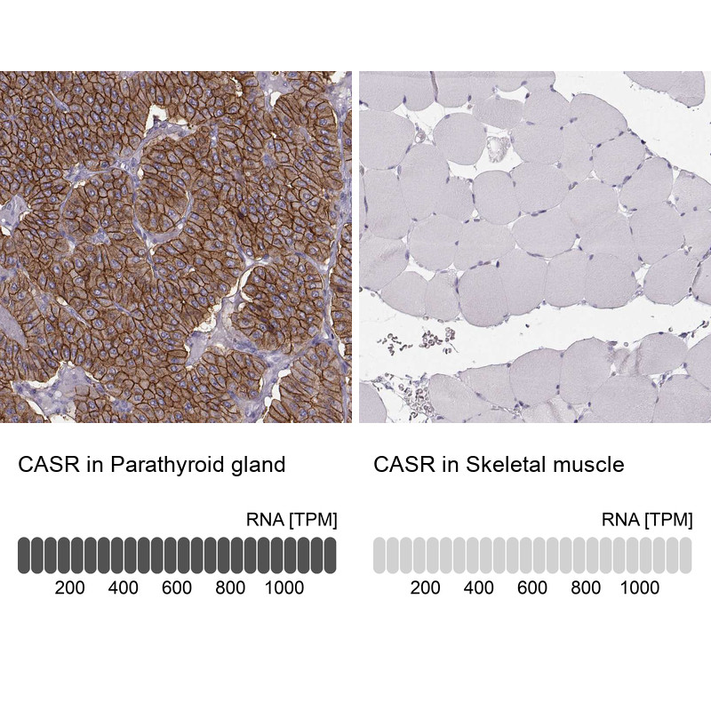 Immunohistochemistry analysis in human parathyroid gland and skeletal muscle tissues using HPA039686 antibody. Corresponding CASR RNA-seq data are presented for the same tissues.