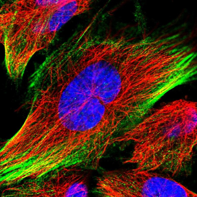 Immunofluorescent staining of human cell line U-251 MG shows localization to actin filaments.
