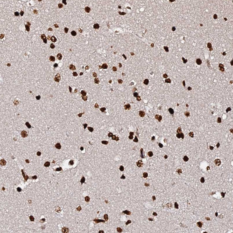 Immunohistochemical staining of human cerebral cortex shows strong nuclear positivity in positivity in neuronal cells and glial cells.
