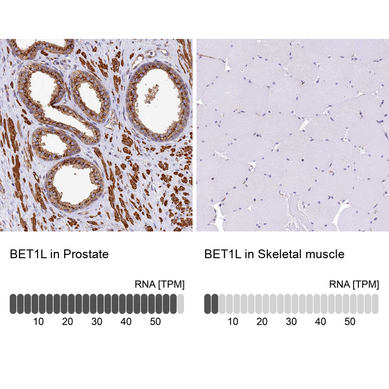 Immunohistochemistry analysis in human prostate and skeletal muscle tissues using HPA039819 antibody. Corresponding BET1L RNA-seq data are presented for the same tissues.