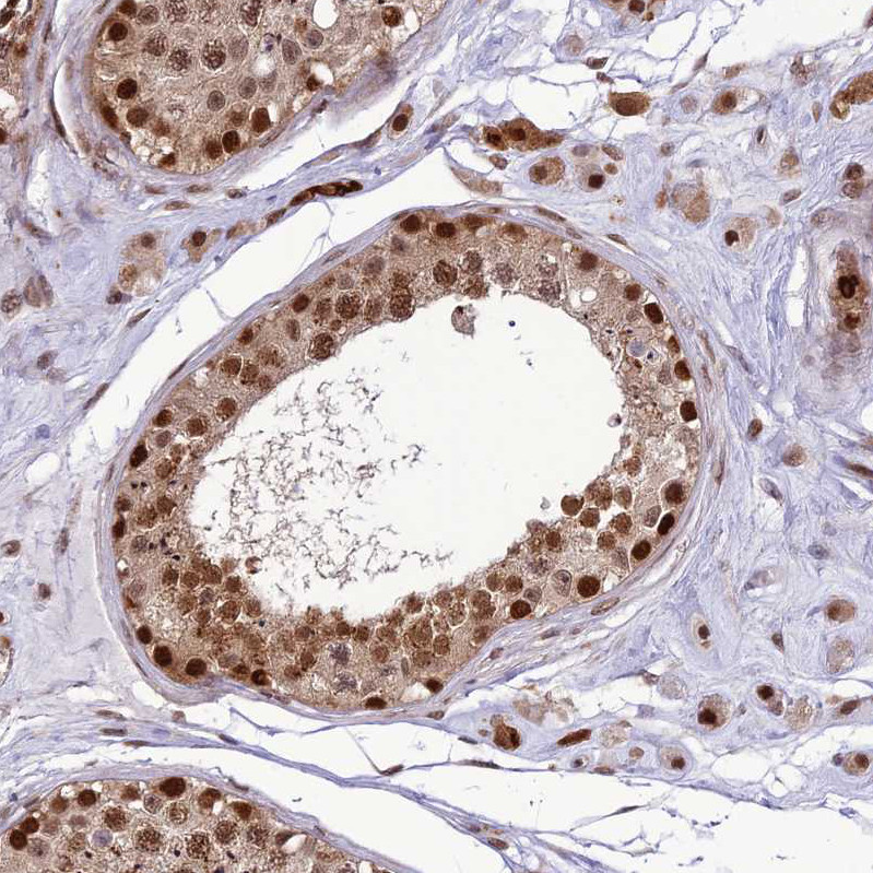 Immunohistochemical staining of human testis shows strong nuclear positivity in cells in seminiferous ducts.