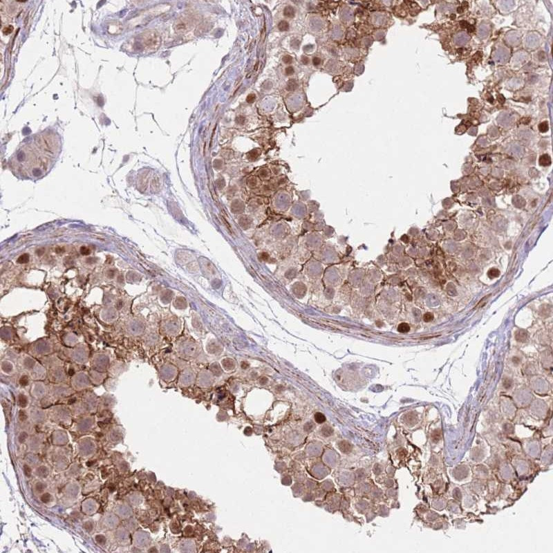 Immunohistochemical staining of human testis shows moderate cytoplasmic and nuclear positivity in cells in seminiferus ducts.