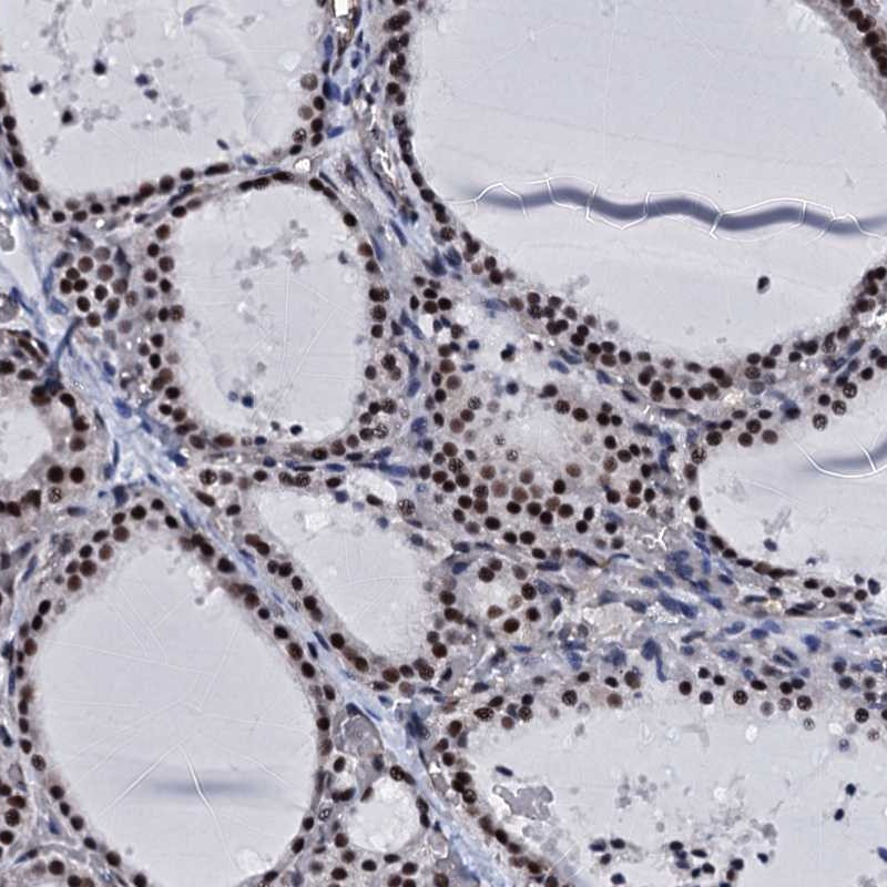 Immunohistochemical staining of human thyroid gland shows strong nuclear positivity in glandular cells.