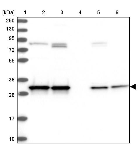 Lane 1: Marker [kDa] 250, 130, 95, 72, 55, 36, 28, 17, 10<br/>Lane 2: Human cell line RT-4<br/>Lane 3: Human cell line U-251MG sp<br/>Lane 4: Human plasma (IgG/HSA depleted)<br/>Lane 5: Human liver tissue<br/>Lane 6: Human tonsil tissue