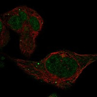 Immunofluorescent staining of human cell line RH-30 shows localization to nucleoplasm & vesicles.